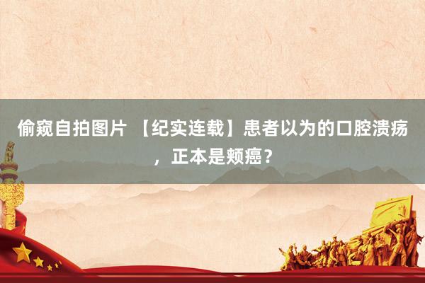 偷窥自拍图片 【纪实连载】患者以为的口腔溃疡，正本是颊癌？
